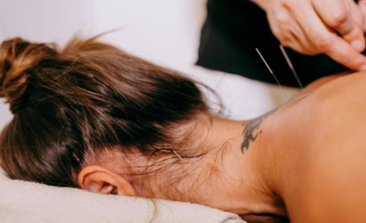 L'acupuncture pour lutter contre les insomnies et mieux dormir